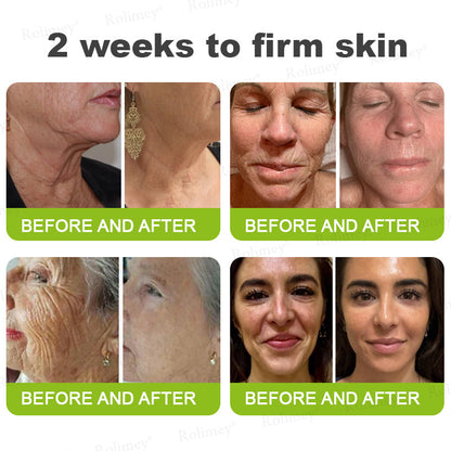 🍃Rolimey®Wrinkle-Lift Tightening stick